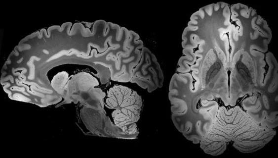 强大MRI技术持续扫描100小时，迄今最详细人脑图像出炉