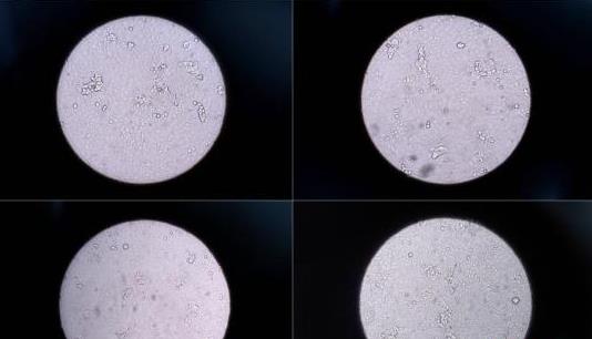 香港科技大学研发新仪器 30分钟检测数百种病毒